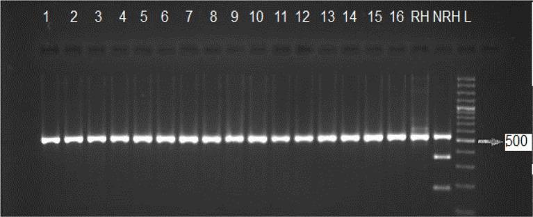 https://cdn.ncbi.nlm.nih.gov/pmc/blobs/5899/6243161/95ee1fc6317a/IJPA-13-382-g002.jpg