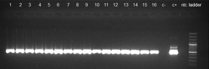 https://cdn.ncbi.nlm.nih.gov/pmc/blobs/5899/6243161/f4c4a59248ba/IJPA-13-382-g001.jpg