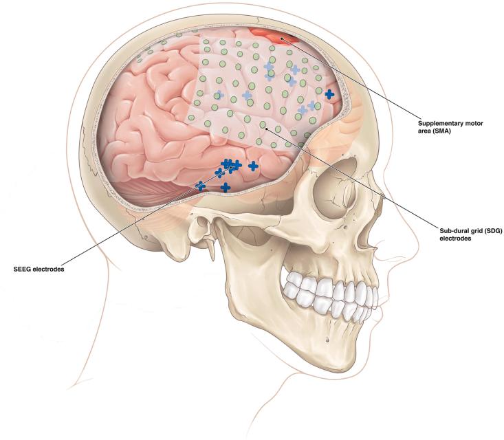 https://cdn.ncbi.nlm.nih.gov/pmc/blobs/58a5/9284396/7a9d9f3ae978/gr1.jpg