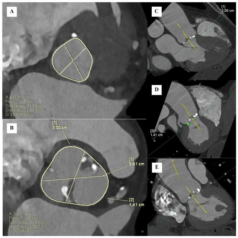 https://cdn.ncbi.nlm.nih.gov/pmc/blobs/58b7/11277735/0aae127a28e8/jcm-13-04064-g004.jpg