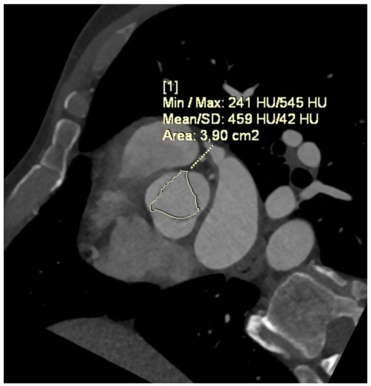 https://cdn.ncbi.nlm.nih.gov/pmc/blobs/58b7/11277735/1f932ef89c0f/jcm-13-04064-g003.jpg