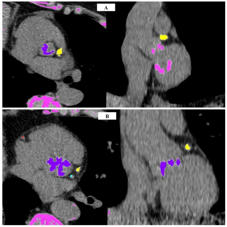 https://cdn.ncbi.nlm.nih.gov/pmc/blobs/58b7/11277735/728cc78fa5d8/jcm-13-04064-g001.jpg