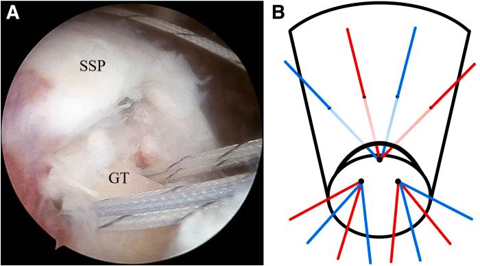 https://cdn.ncbi.nlm.nih.gov/pmc/blobs/58be/11258870/4ec0cdc3669d/gr4.jpg
