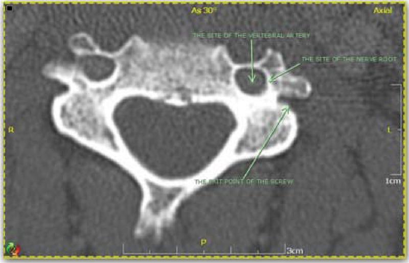 https://cdn.ncbi.nlm.nih.gov/pmc/blobs/58bf/3864406/23e58cde9a2e/f00041-4.jpg