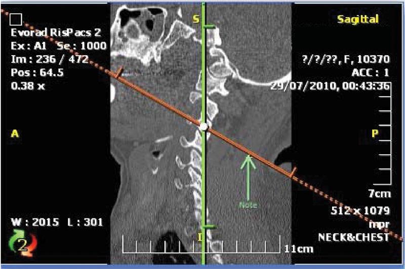 https://cdn.ncbi.nlm.nih.gov/pmc/blobs/58bf/3864406/7d29720e441d/f00041-3.jpg