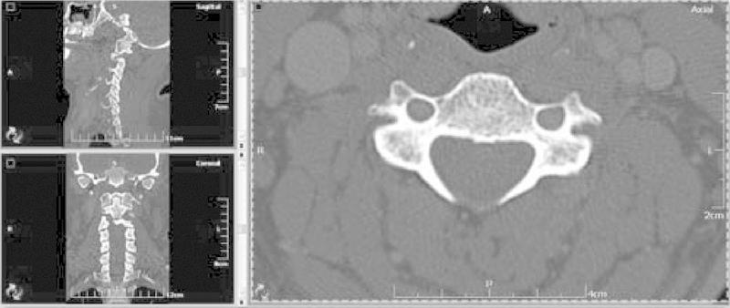 https://cdn.ncbi.nlm.nih.gov/pmc/blobs/58bf/3864406/a2103f890a84/f00041-1.jpg