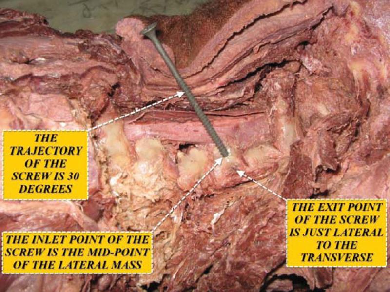 https://cdn.ncbi.nlm.nih.gov/pmc/blobs/58bf/3864406/d8253612cb5d/f00041-5.jpg