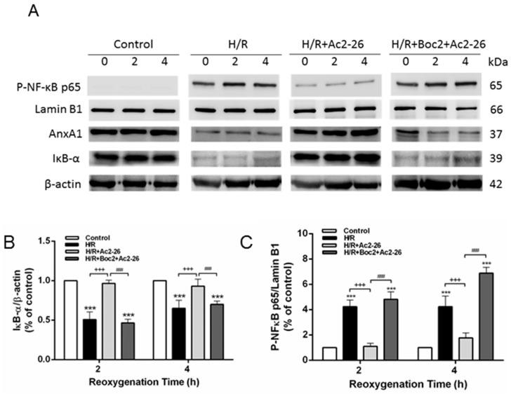 https://cdn.ncbi.nlm.nih.gov/pmc/blobs/58c1/5578160/f0fe50a4b244/ijms-18-01771-g010a.jpg