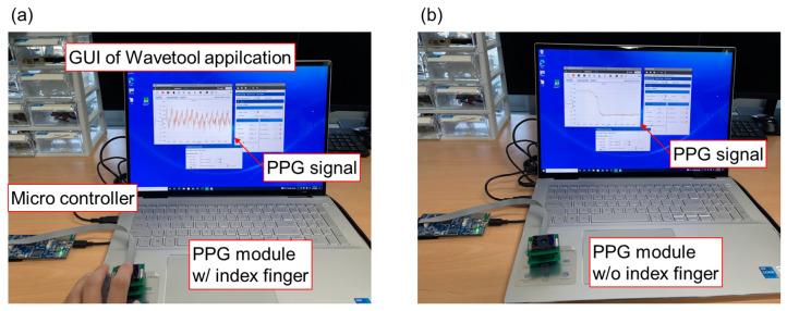 https://cdn.ncbi.nlm.nih.gov/pmc/blobs/58cf/10886646/a9c796a5cac1/biosensors-14-00109-g010.jpg