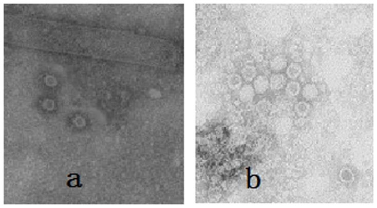 https://cdn.ncbi.nlm.nih.gov/pmc/blobs/58e0/3894932/45a8e0296819/pone.0079575.g003.jpg