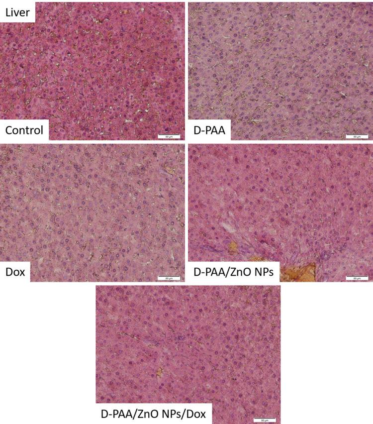 https://cdn.ncbi.nlm.nih.gov/pmc/blobs/58ee/11566607/1c902333e6f9/IJN-19-11719-g0016.jpg