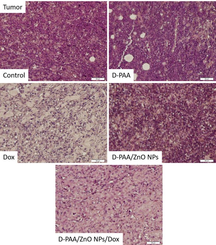 https://cdn.ncbi.nlm.nih.gov/pmc/blobs/58ee/11566607/4eed0ed60138/IJN-19-11719-g0015.jpg