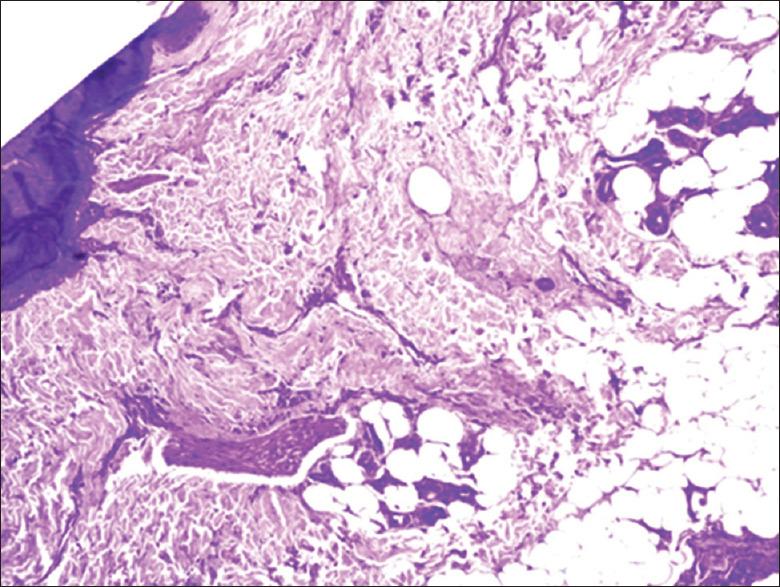 https://cdn.ncbi.nlm.nih.gov/pmc/blobs/58ef/12251984/34f8ac440a62/IJT-17-58-g003.jpg