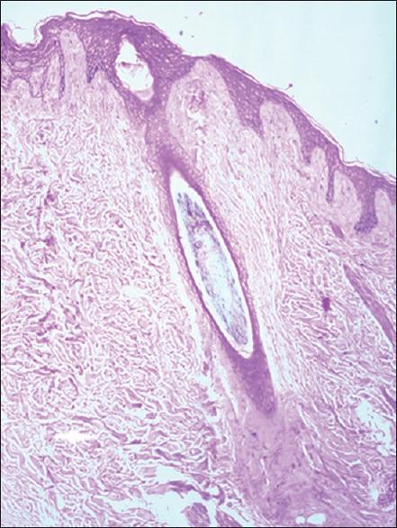 https://cdn.ncbi.nlm.nih.gov/pmc/blobs/58ef/12251984/3bf83a726dde/IJT-17-58-g002.jpg