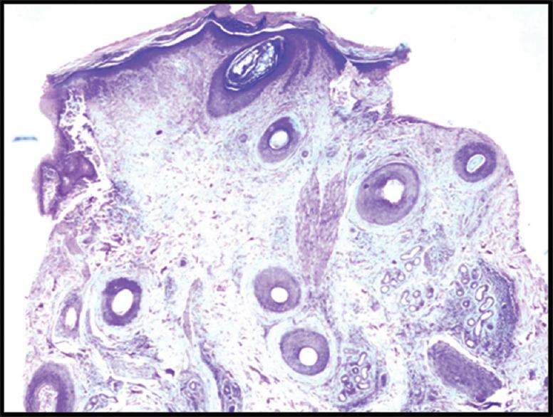 https://cdn.ncbi.nlm.nih.gov/pmc/blobs/58ef/12251984/e7b653831ced/IJT-17-58-g001.jpg