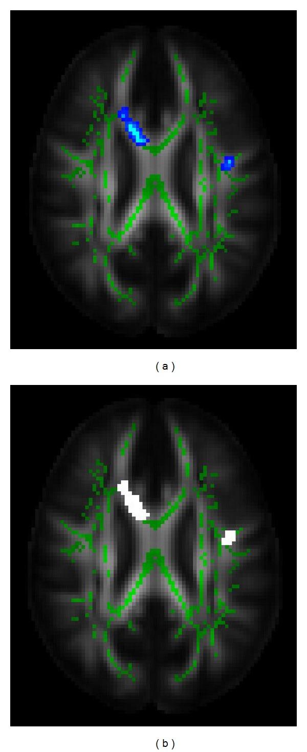 https://cdn.ncbi.nlm.nih.gov/pmc/blobs/58f3/4145738/831975b775f4/BMRI2014-725052.005.jpg