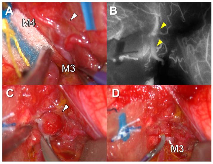 https://cdn.ncbi.nlm.nih.gov/pmc/blobs/58f4/10046659/8fdbd2e14d47/brainsci-13-00440-g006.jpg