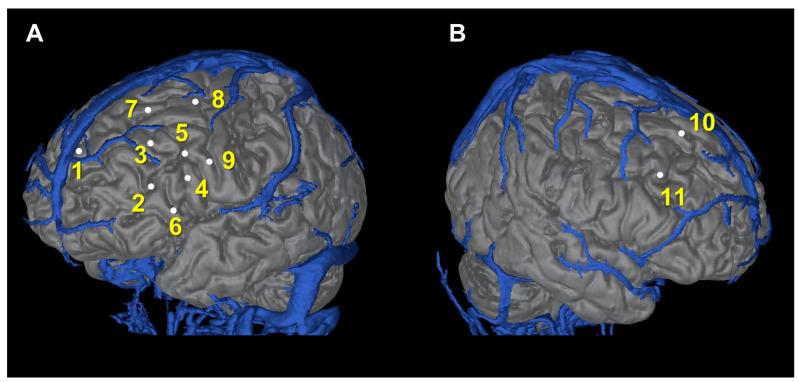 https://cdn.ncbi.nlm.nih.gov/pmc/blobs/58f4/10046659/a275b4aba310/brainsci-13-00440-g002.jpg