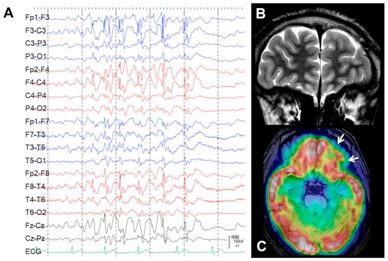 https://cdn.ncbi.nlm.nih.gov/pmc/blobs/58f4/10046659/d47b6eac0e57/brainsci-13-00440-g001.jpg