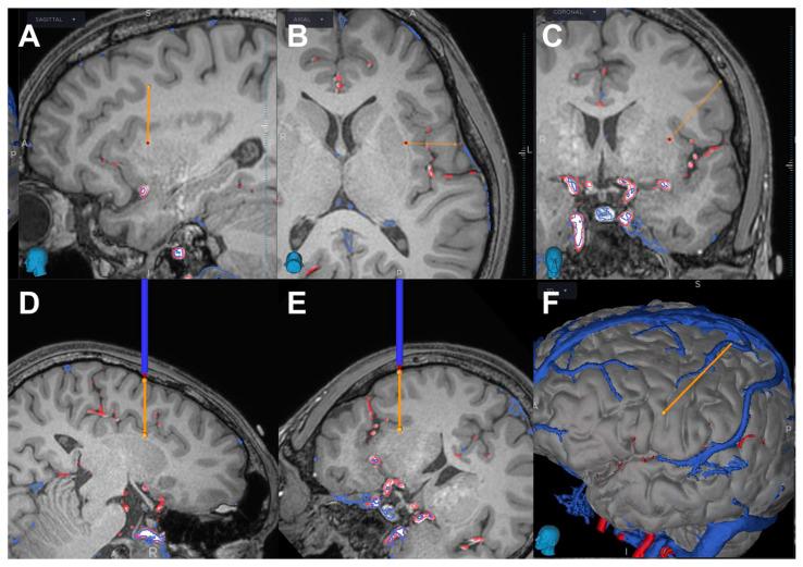 https://cdn.ncbi.nlm.nih.gov/pmc/blobs/58f4/10046659/faaaac88f317/brainsci-13-00440-g004.jpg
