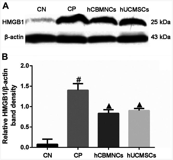 https://cdn.ncbi.nlm.nih.gov/pmc/blobs/58fb/7571324/211a222338ad/etm-20-06-09274-g05.jpg
