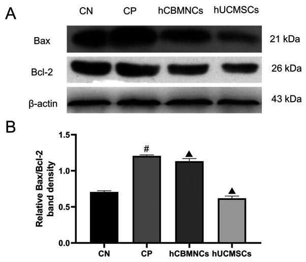 https://cdn.ncbi.nlm.nih.gov/pmc/blobs/58fb/7571324/7103a3e609a4/etm-20-06-09274-g04.jpg