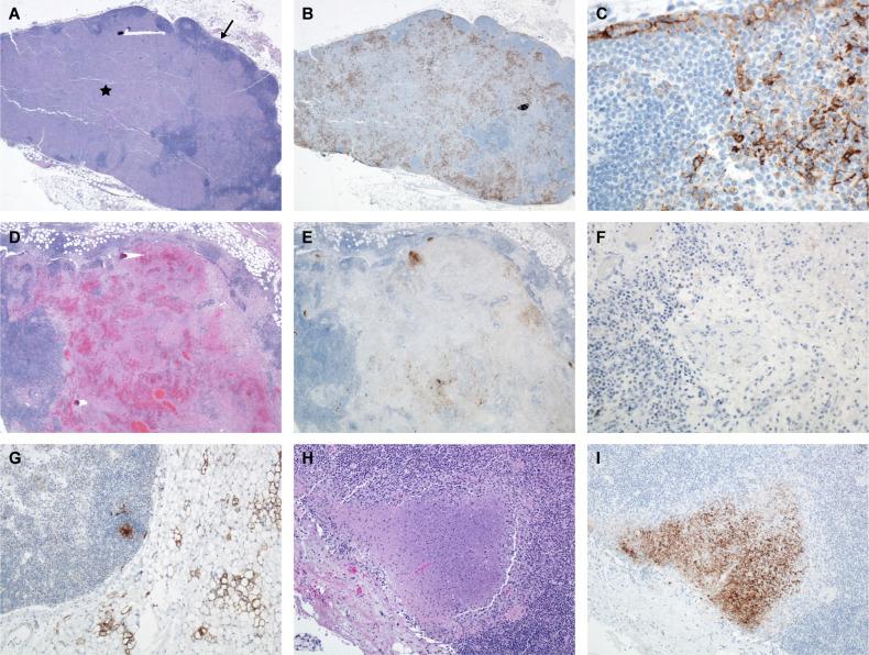 https://cdn.ncbi.nlm.nih.gov/pmc/blobs/58fd/10884106/30bd81d2ccbb/fcimb-14-1341891-g001.jpg