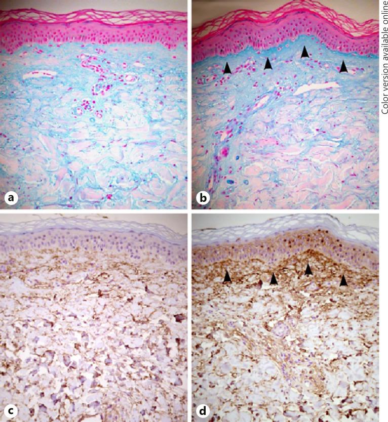https://cdn.ncbi.nlm.nih.gov/pmc/blobs/58fe/6827440/73f07d72178b/dpa-0006-0045-g01.jpg