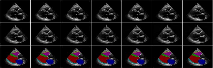 https://cdn.ncbi.nlm.nih.gov/pmc/blobs/58ff/12399644/c216b4c2201f/fphys-16-1629121-g002.jpg