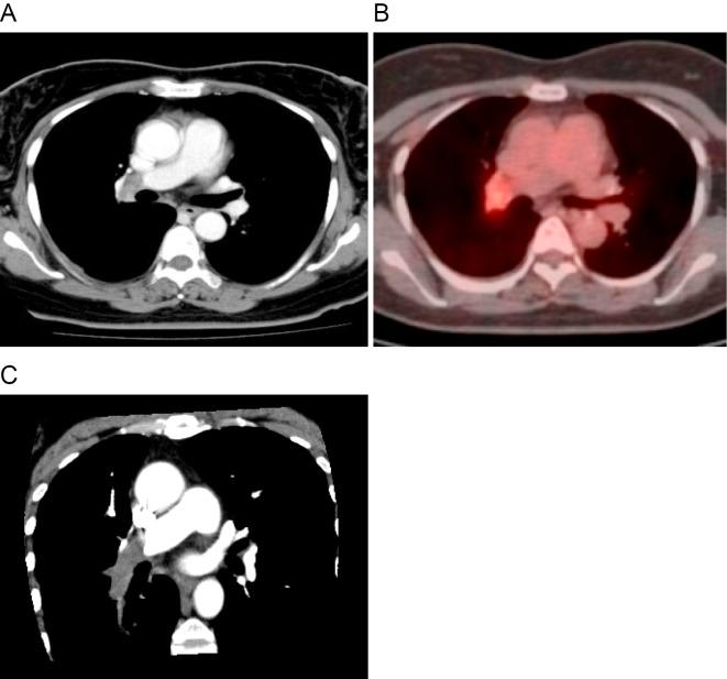 https://cdn.ncbi.nlm.nih.gov/pmc/blobs/5900/5457927/82203380555d/1349-7235-56-0823-g001.jpg