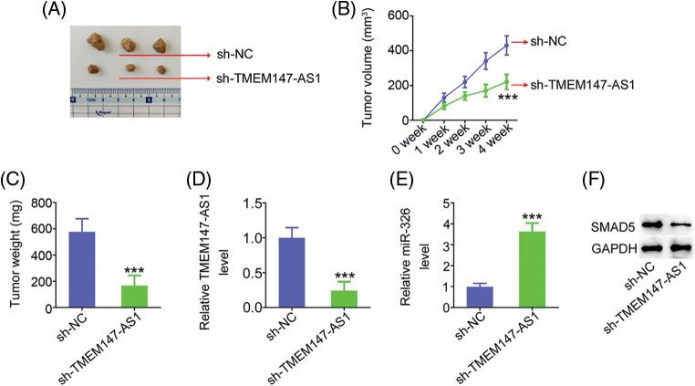 https://cdn.ncbi.nlm.nih.gov/pmc/blobs/5905/10208078/1c43ed36b16b/OncolRes-29-3568-f011.jpg