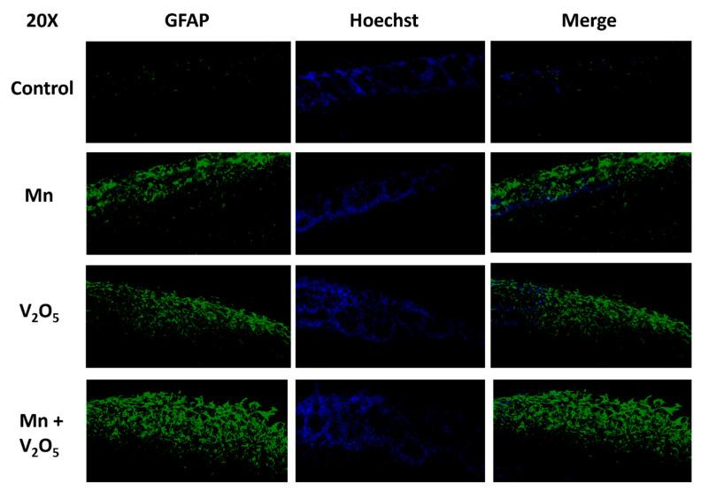 https://cdn.ncbi.nlm.nih.gov/pmc/blobs/5909/11121436/406110eb5684/ijms-25-05285-g010.jpg