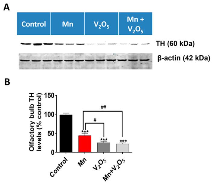 https://cdn.ncbi.nlm.nih.gov/pmc/blobs/5909/11121436/8aa42e3c87b4/ijms-25-05285-g003.jpg