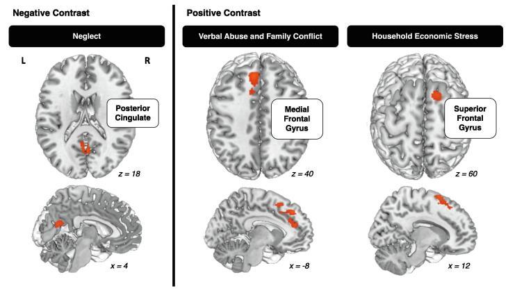 https://cdn.ncbi.nlm.nih.gov/pmc/blobs/5909/11635096/0093fb9bcb8f/gr3.jpg