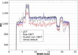 https://cdn.ncbi.nlm.nih.gov/pmc/blobs/5909/5690008/7df0c5edff4b/ACM2-16-216-g006.jpg