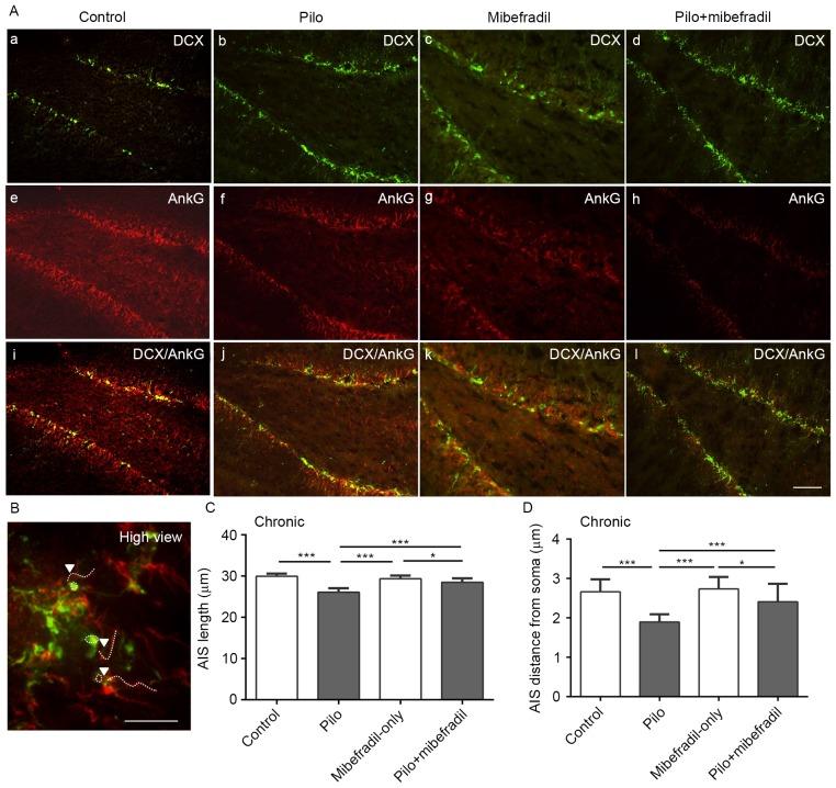 https://cdn.ncbi.nlm.nih.gov/pmc/blobs/590e/5547972/cb220f3cfbd4/MMR-16-03-3169-g03.jpg