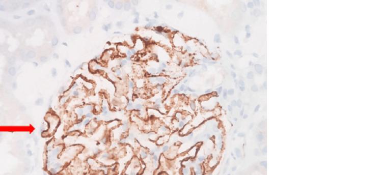 https://cdn.ncbi.nlm.nih.gov/pmc/blobs/5912/11538043/13cf8f2bceb8/cureus-0016-00000070960-i02.jpg