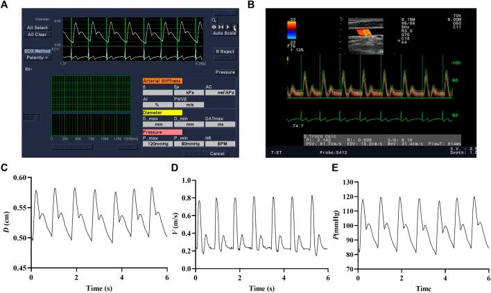 https://cdn.ncbi.nlm.nih.gov/pmc/blobs/5913/10925650/cd42e2038b0e/fphys-15-1348811-g002.jpg