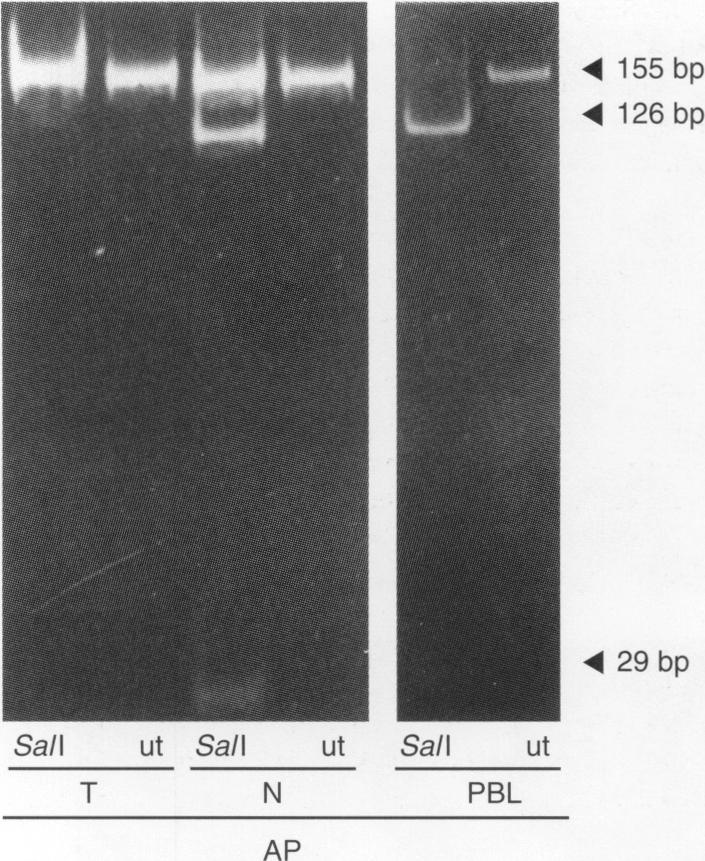 https://cdn.ncbi.nlm.nih.gov/pmc/blobs/5914/2149930/18eb91f688b0/brjcancer00080-0082-a.jpg