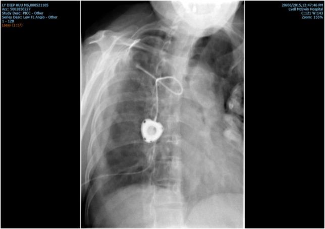 https://cdn.ncbi.nlm.nih.gov/pmc/blobs/5914/5045540/0d6e78e4241d/omw079f02.jpg