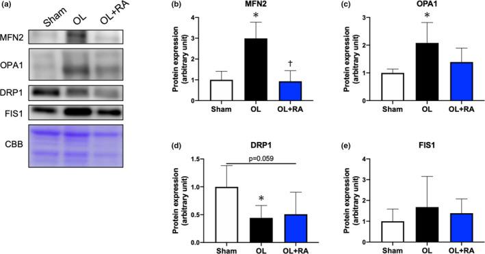 https://cdn.ncbi.nlm.nih.gov/pmc/blobs/5915/7931617/4b48eca2acfc/PHY2-9-e14789-g008.jpg