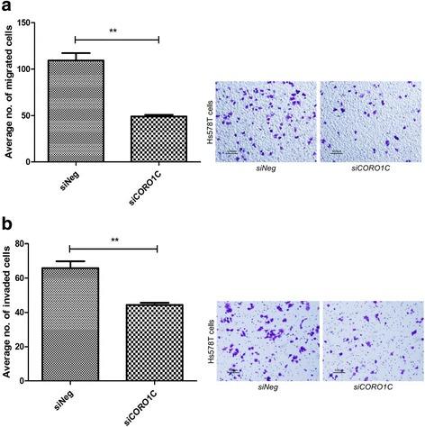 https://cdn.ncbi.nlm.nih.gov/pmc/blobs/591e/5356414/ed82fb8f5e08/12885_2017_3187_Fig9_HTML.jpg