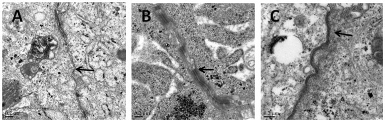 https://cdn.ncbi.nlm.nih.gov/pmc/blobs/5922/4125175/417bce1f7a59/pone.0104032.g006.jpg