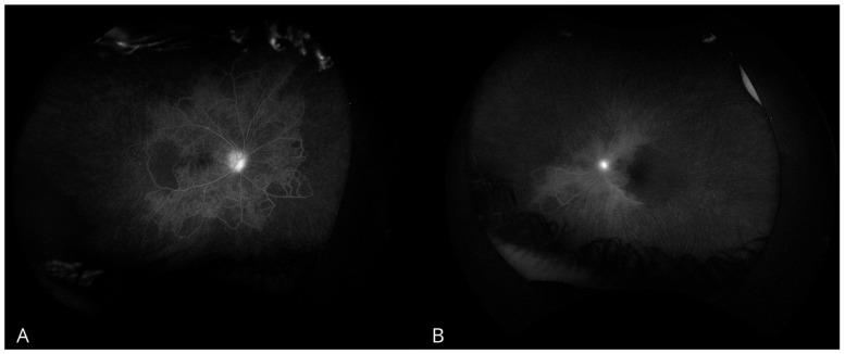 https://cdn.ncbi.nlm.nih.gov/pmc/blobs/592b/11761241/c3b87d59d0c4/biomedicines-13-00148-g001.jpg