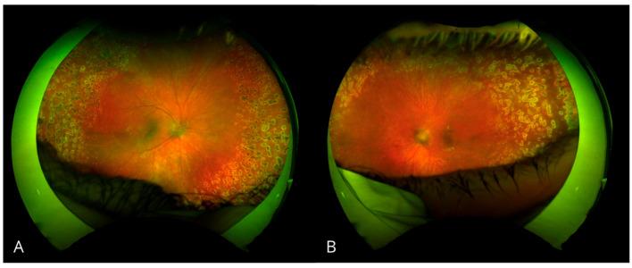 https://cdn.ncbi.nlm.nih.gov/pmc/blobs/592b/11761241/c5c25d3965df/biomedicines-13-00148-g002.jpg