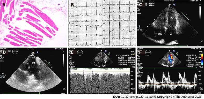 https://cdn.ncbi.nlm.nih.gov/pmc/blobs/592d/10237099/9cb2ddcebf5c/WJG-29-3040-g001.jpg