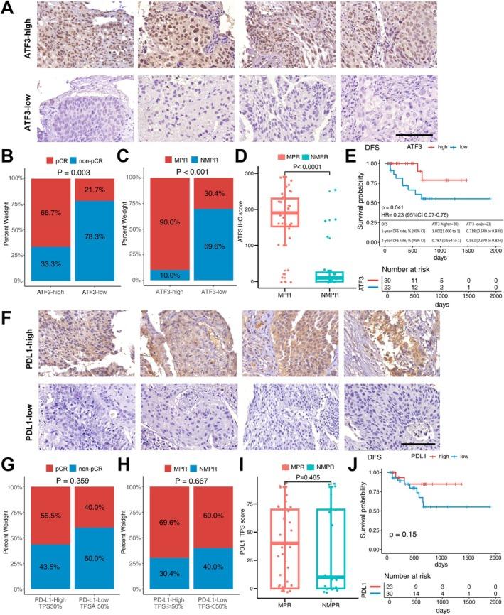 https://cdn.ncbi.nlm.nih.gov/pmc/blobs/592d/11994479/586935d00248/TCA-16-e70056-g002.jpg