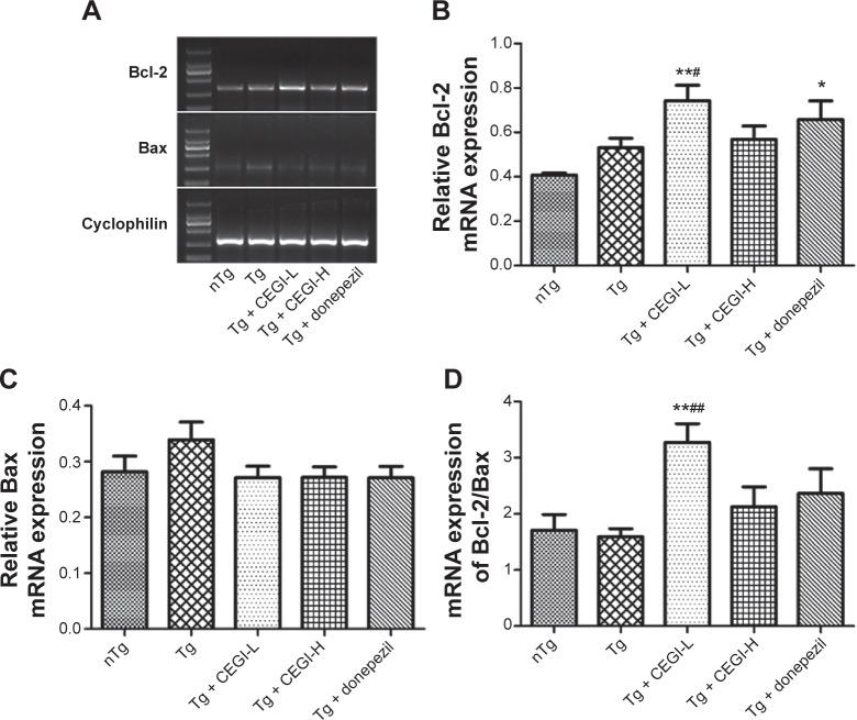 https://cdn.ncbi.nlm.nih.gov/pmc/blobs/592d/4356454/51707f97b720/ndt-11-537Fig5.jpg