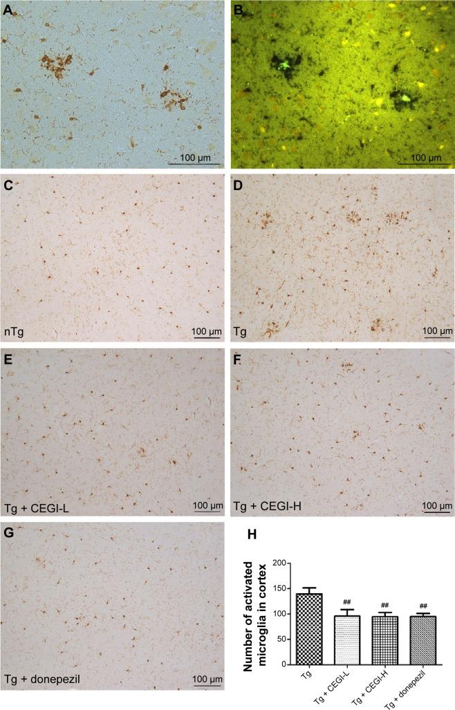 https://cdn.ncbi.nlm.nih.gov/pmc/blobs/592d/4356454/67f155231e87/ndt-11-537Fig6.jpg
