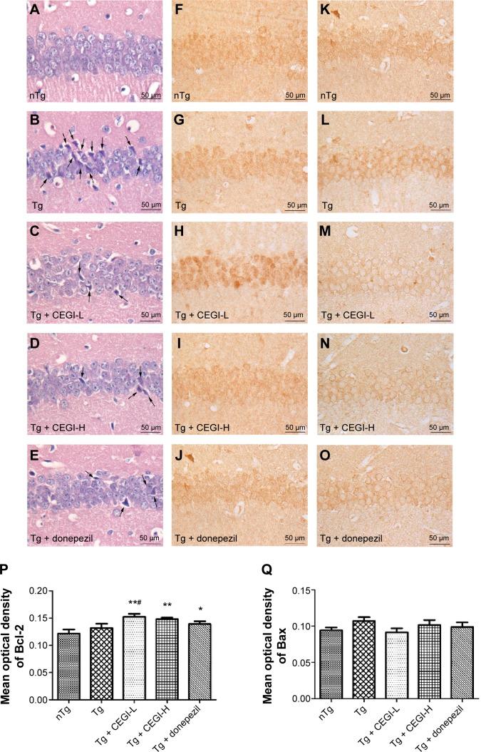 https://cdn.ncbi.nlm.nih.gov/pmc/blobs/592d/4356454/872f8b31410c/ndt-11-537Fig4.jpg